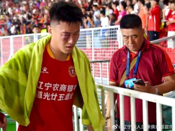 赵健博进行了鼻骨复位手术，需要等半个月后再进行复查